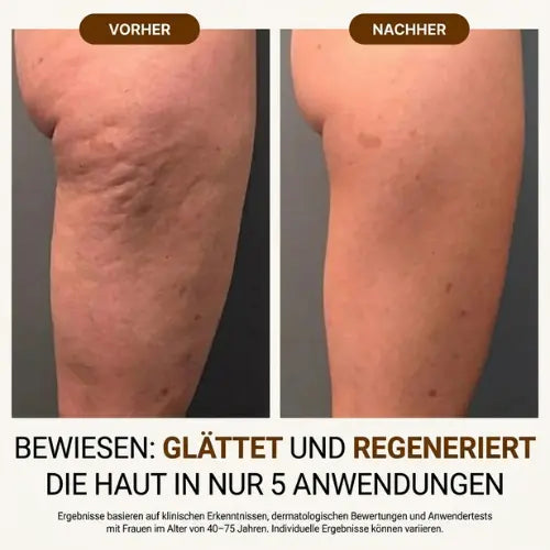 Seidiges Glow-Öl™ · versiegelt 72h Feuchtigkeit nach dem Peeling