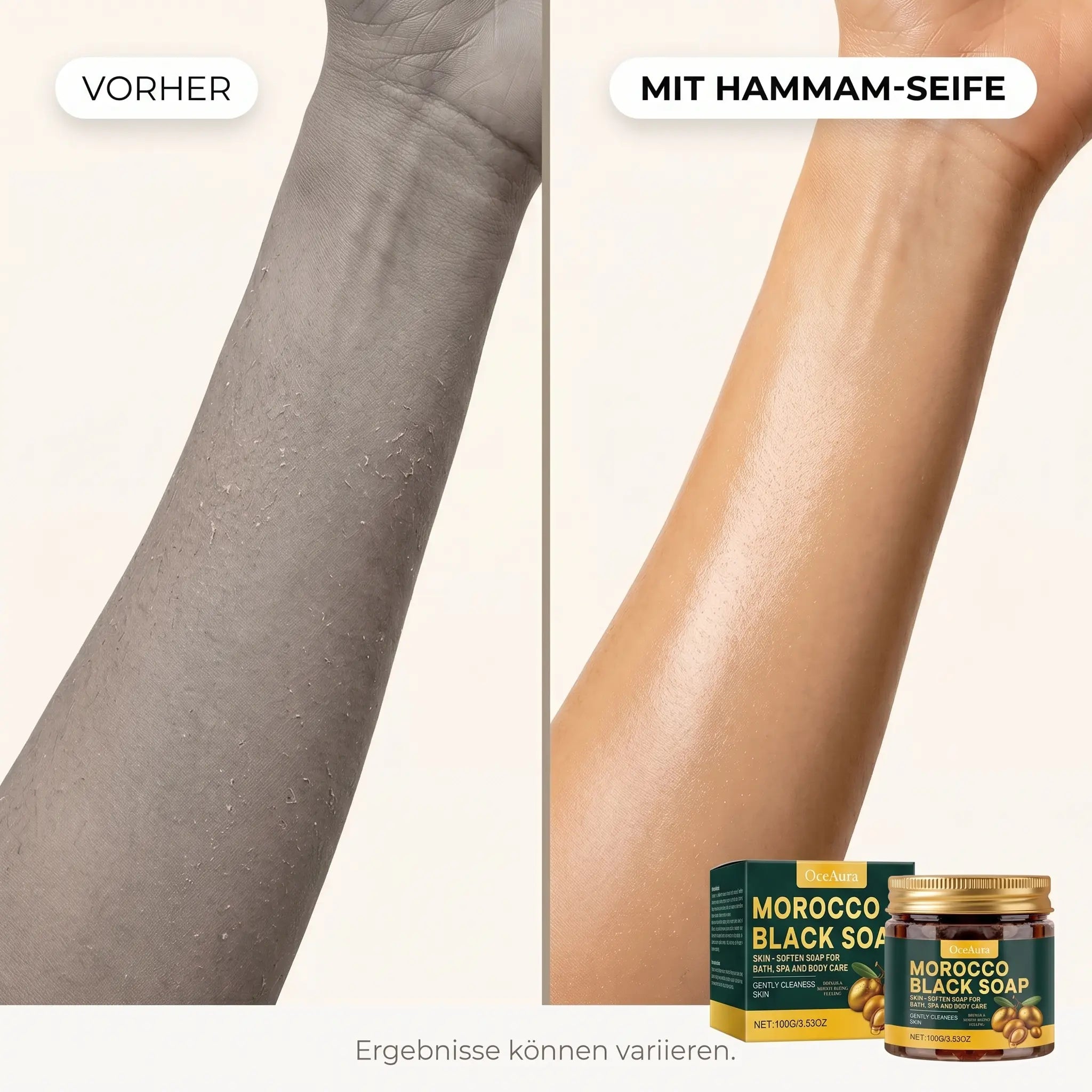 Peeling-Aktivator™ Seife · öffnet die Poren, 3× tieferes Peeling