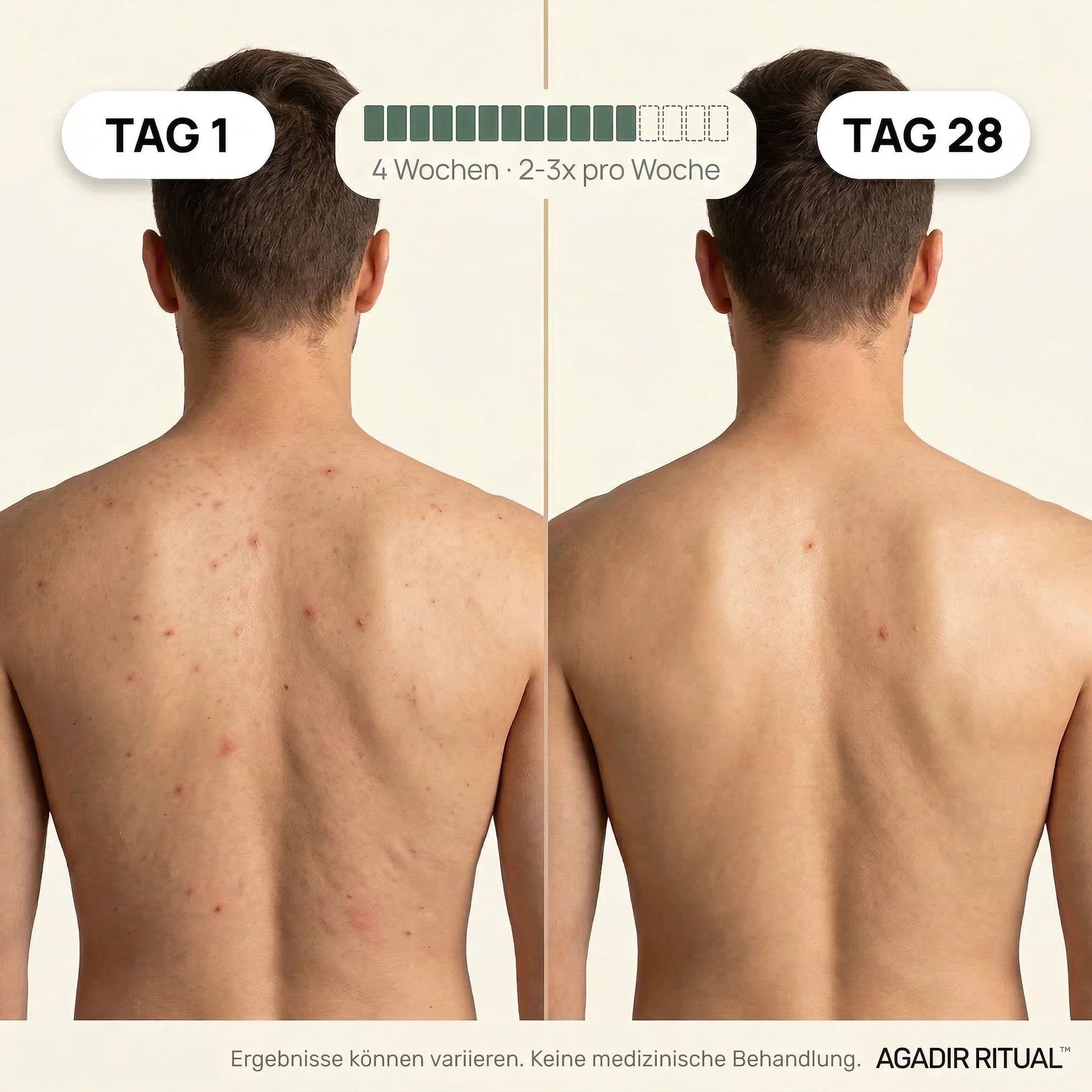 Premium Hammam Peeling Duschtuch™ aus Bambusfaser, Aktivkohle & AG+ Silberionen